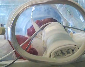Launch of Breathing Life Lung Centre for Children